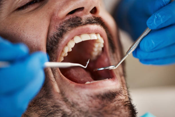Best Emergency Dentist Near Me  in Normandy Park, WA